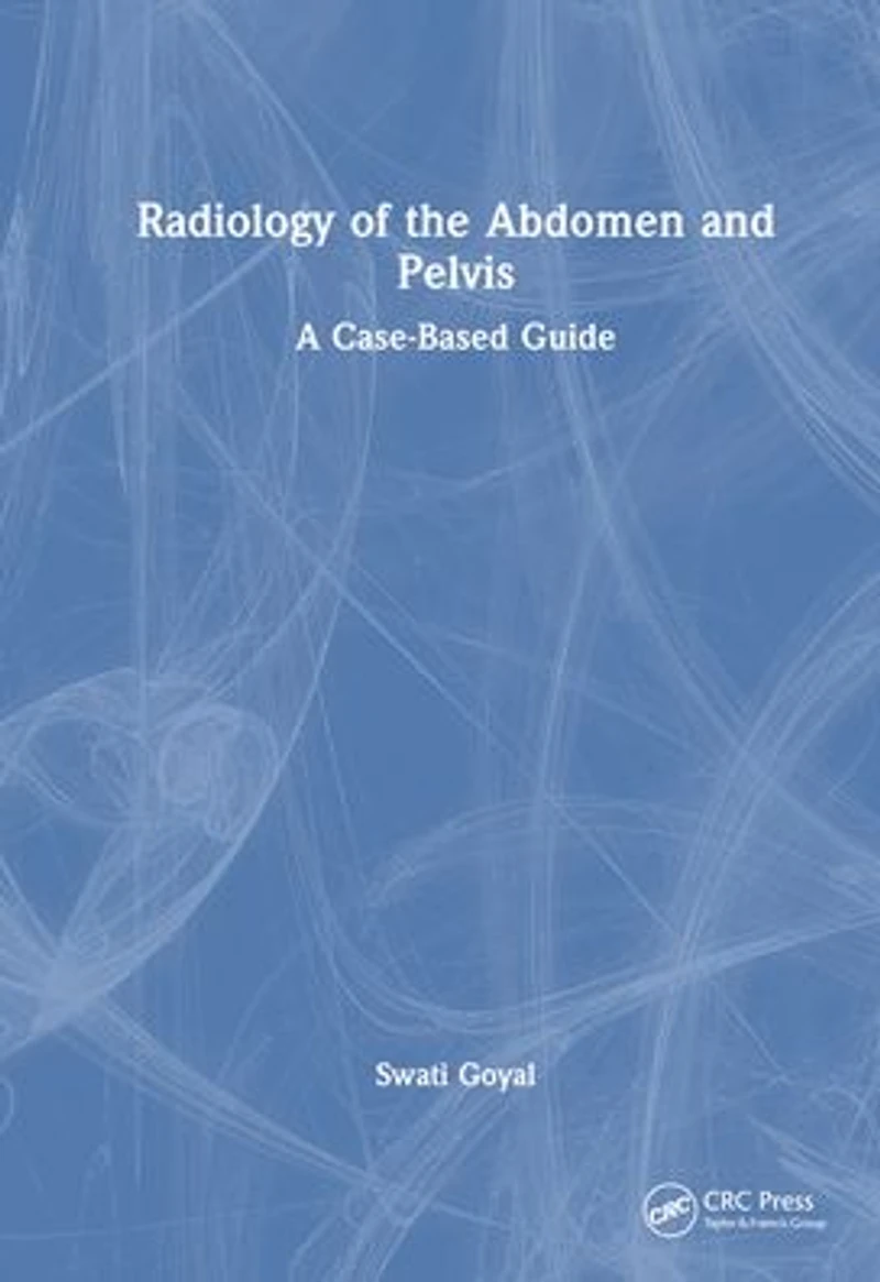 Radiology of the Abdomen and Pelvis: A Case-Based Guide