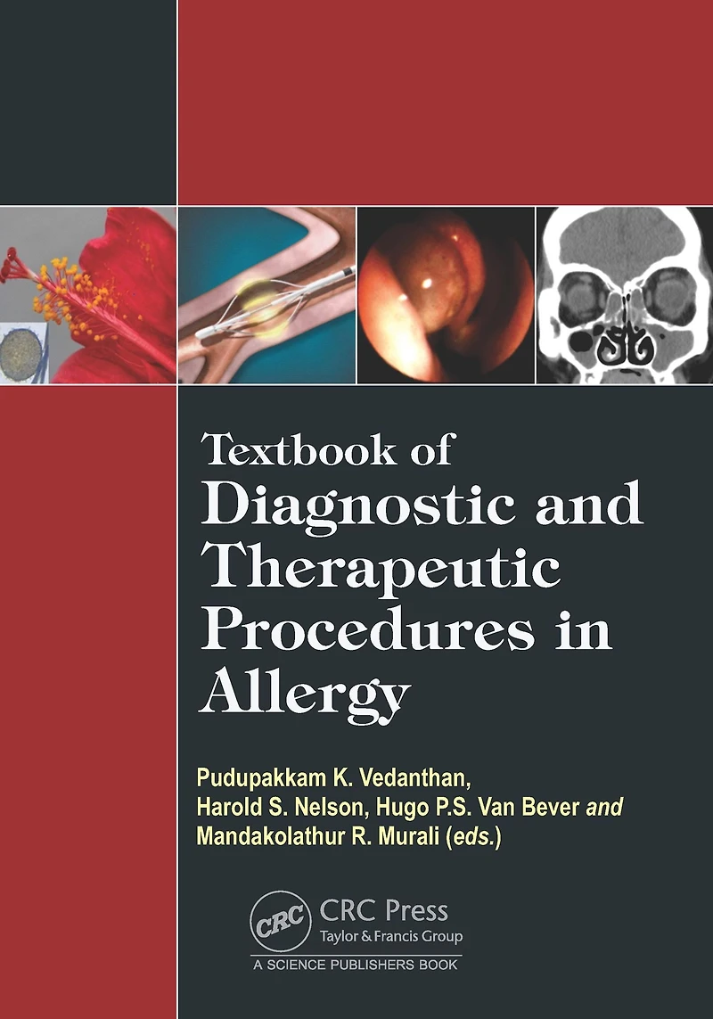 Textbook of Diagnostic and Therapeutic Procedures Allergy