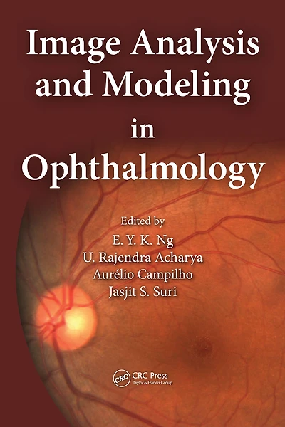 Image Analysis and Modeling Ophthalmology