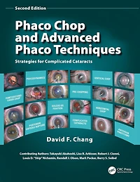 Phaco Chop and Advanced Techniques: Strategies for Complicated Cataracts