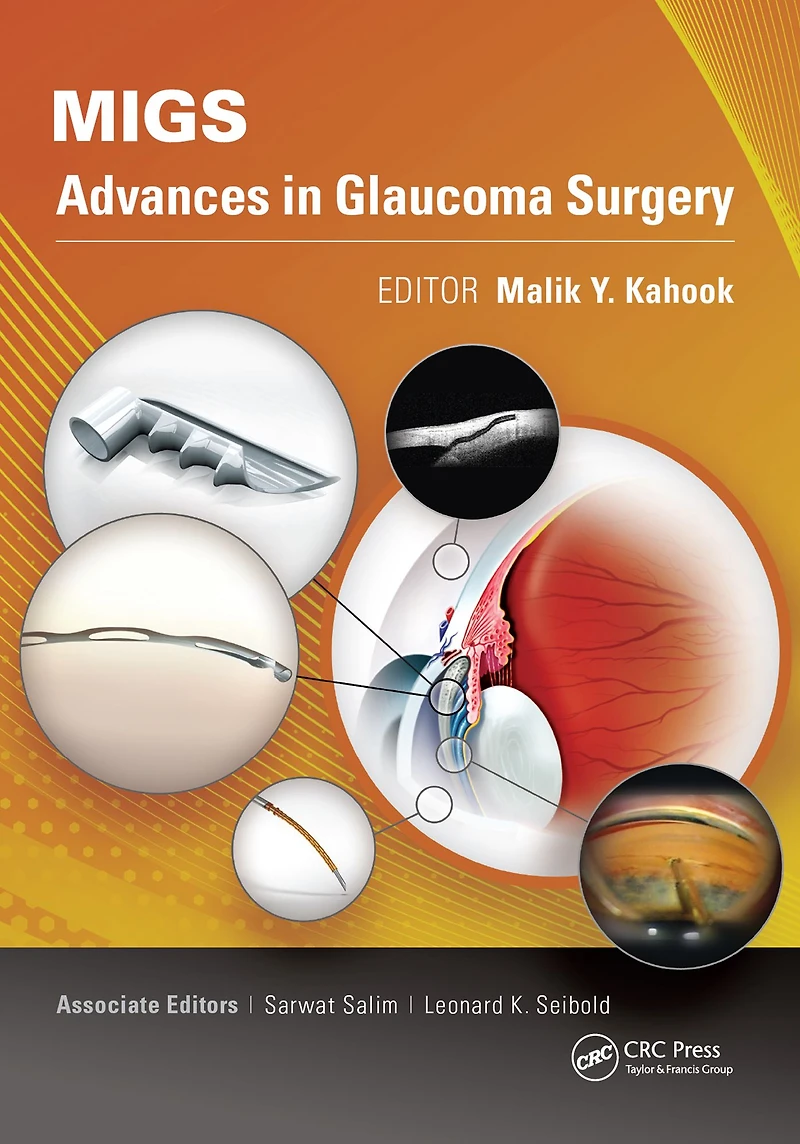 MIGS: Advances Glaucoma Surgery