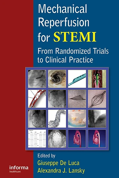 Mechanical Reperfusion for STEMI: From Randomized Trials to Clinical Practice