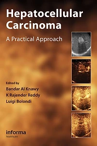 Hepatocellular Carcinoma: A Practical Approach