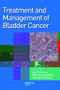 Treatment and Management of Bladder Cancer