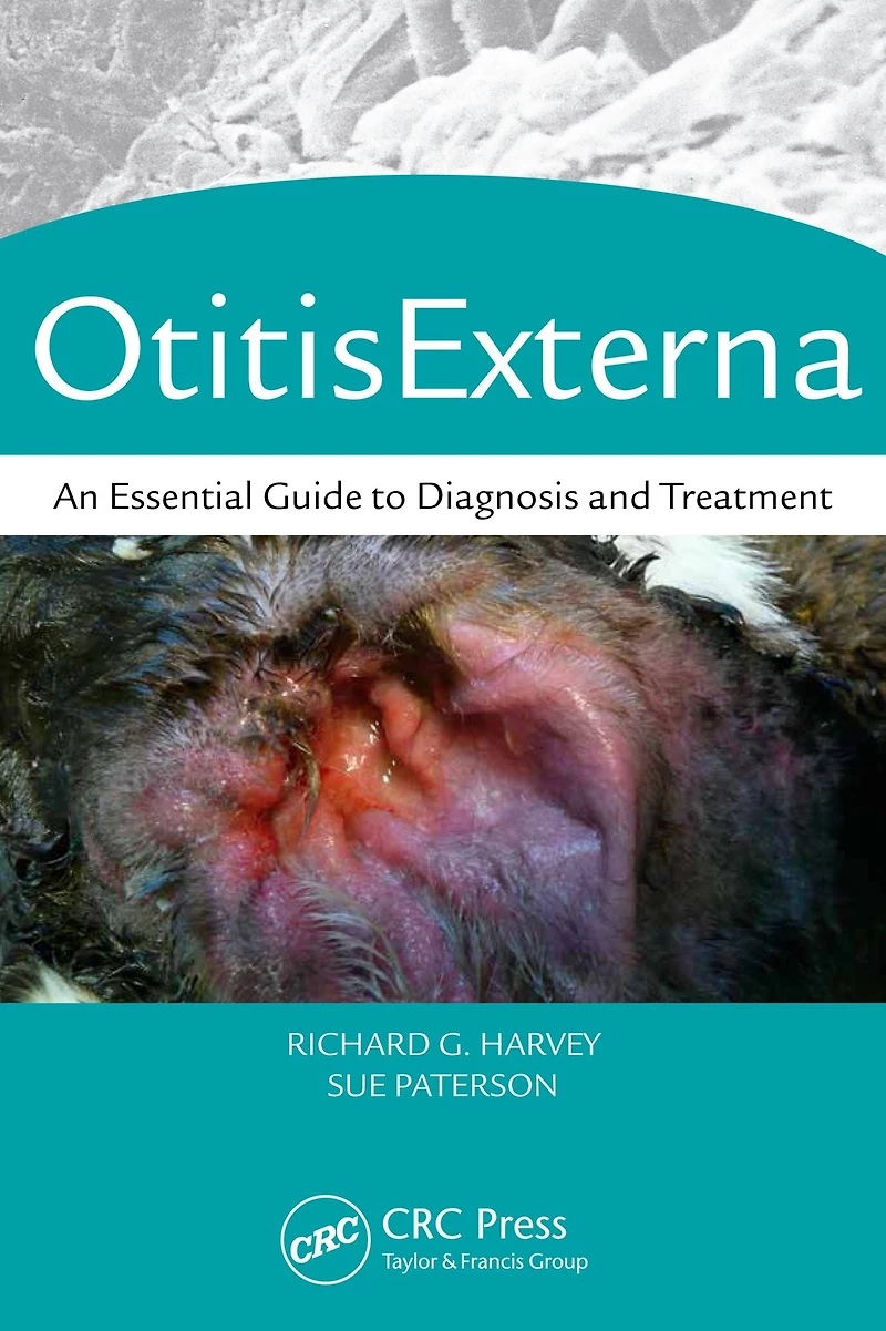 Otitis Externa: An Essential Guide to Diagnosis and Treatment