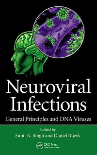 Neuroviral Infections: General Principles and DNA Viruses