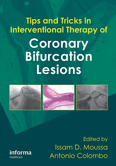 Tips and Tricks Interventional Therapy of Coronary Bifurcation Lesions