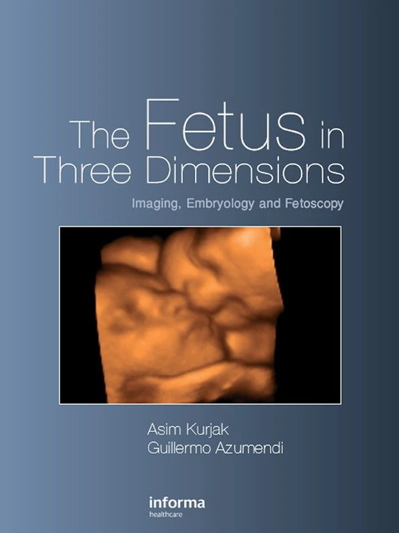 The Fetus Three Dimensions: Imaging, Embryology and Fetoscopy