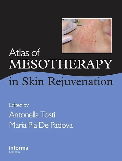 Atlas of Mesotherapy Skin Rejuvenation