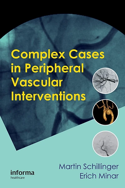 Complex Cases Peripheral Vascular Interventions