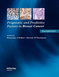 Prognostic and Predictive Factors Breast Cancer