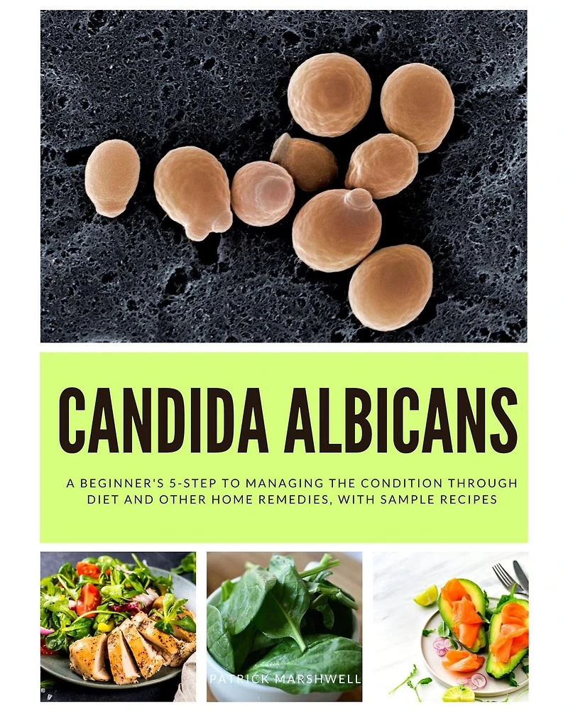 Candida Albicans: A Beginner's 5-Step to Managing the Condition Through Diet and Other Home Remedies, With Sample Recipes