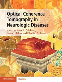 Optical Coherence Tomography Neurologic Diseases