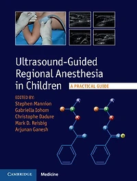 Ultrasound-Guided Regional Anesthesia Children: A Practical Guide