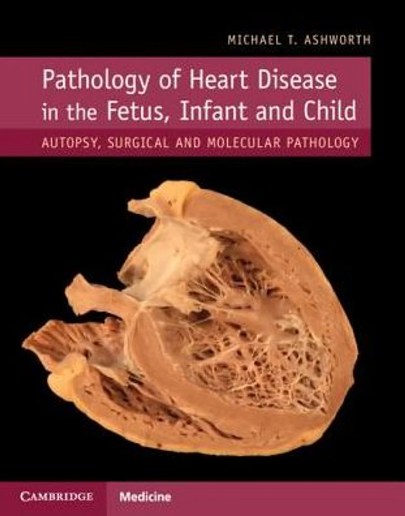 Pathology of Heart Disease the Fetus, Infant and Child: Autopsy, Surgical Molecular