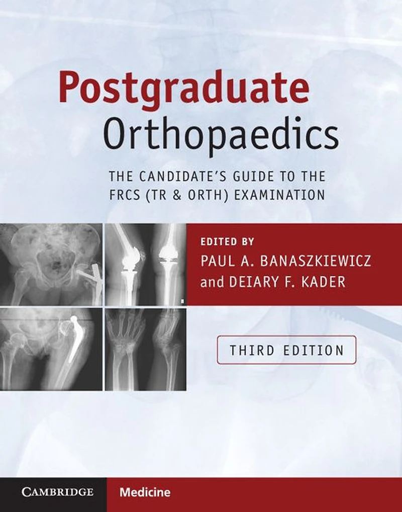 Postgraduate Orthopaedics: the Candidate's Guide to FRCS (Tr & Orth) Examination