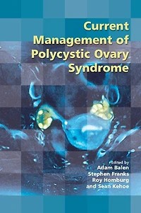 Current Management of Polycystic Ovary Syndrome