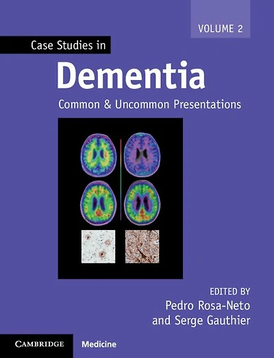 Case Studies Dementia: Common and Uncommon Presentations