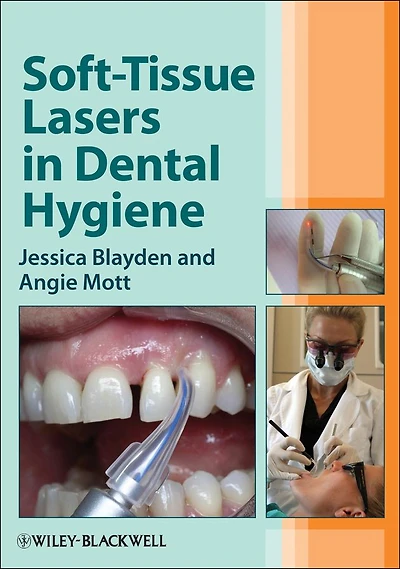 Soft-Tissue Lasers Dental Hygiene