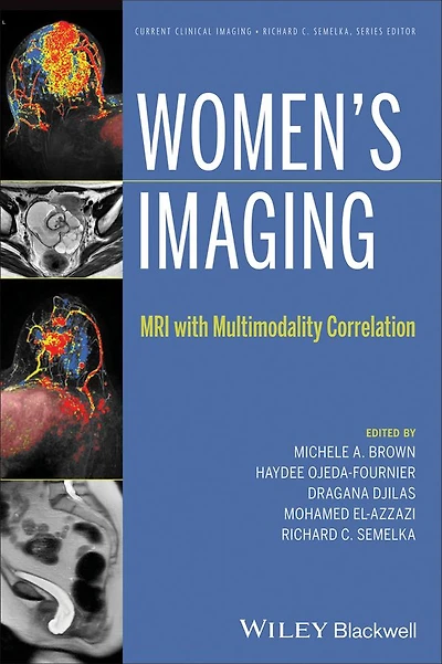 Women's Imaging: MRI with Multimodality Correlation