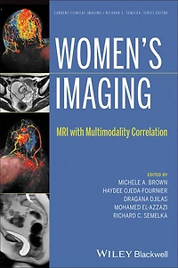 Women's Imaging: MRI with Multimodality Correlation