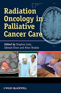Radiation Oncology Palliative Cancer Care