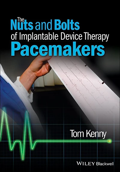 The Nuts and Bolts of Implantable Device Therapy: Pacemakers