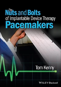 The Nuts and Bolts of Implantable Device Therapy: Pacemakers