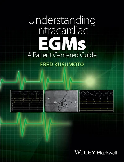 Understanding Intracardiac EGMs: A Patient Centered Guide