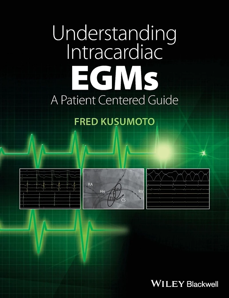 Understanding Intracardiac EGMs: A Patient Centered Guide