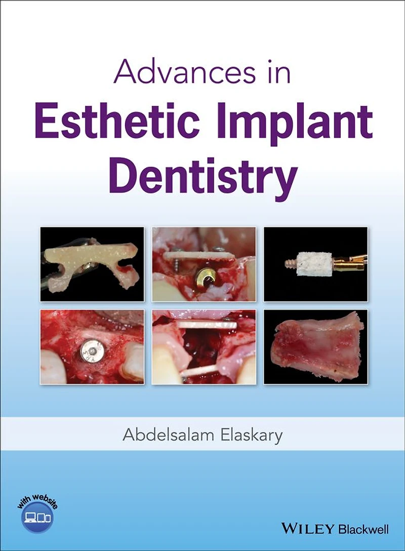 Advances Esthetic Implant Dentistry
