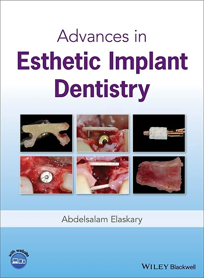 Advances Esthetic Implant Dentistry