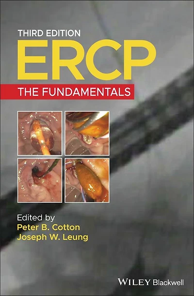 ERCP: The Fundamentals