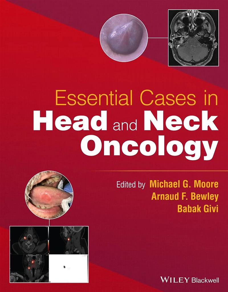 Essential Cases Head and Neck Oncology