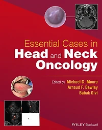 Essential Cases Head and Neck Oncology
