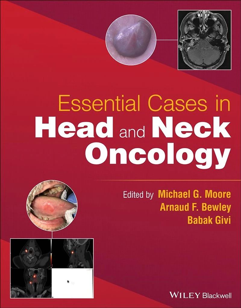 Essential Cases Head and Neck Oncology