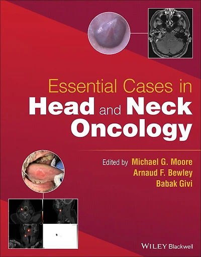 Essential Cases Head and Neck Oncology