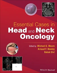 Essential Cases Head and Neck Oncology