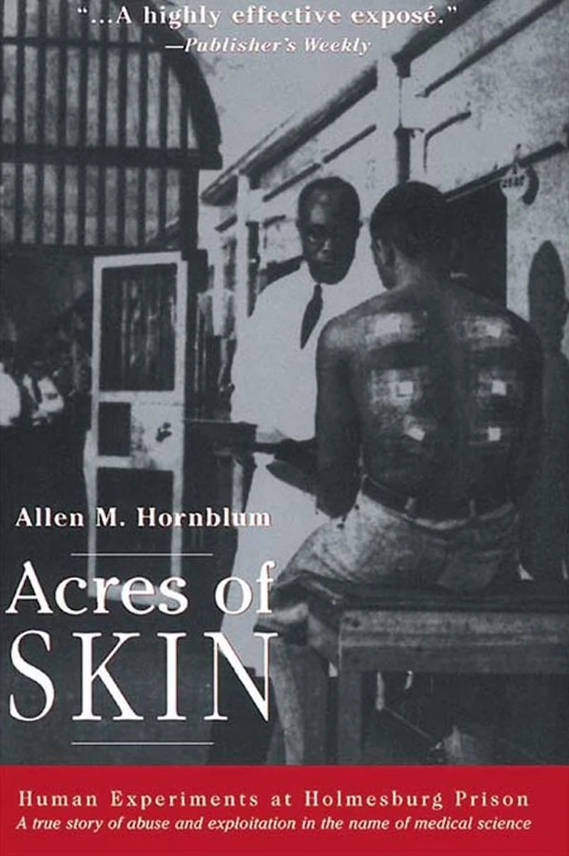 Acres of Skin: Human Experiments at Holmesburg Prison