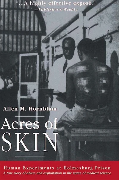 Acres of Skin: Human Experiments at Holmesburg Prison