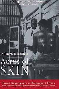 Acres of Skin: Human Experiments at Holmesburg Prison