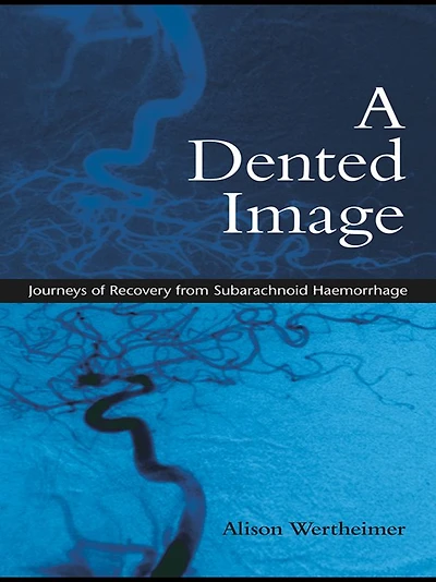 A Dented Image: Journeys of Recovery from Subarachnoid Haemorrhage
