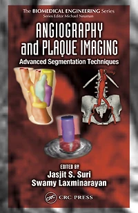Angiography and Plaque Imaging: Advanced Segmentation Techniques