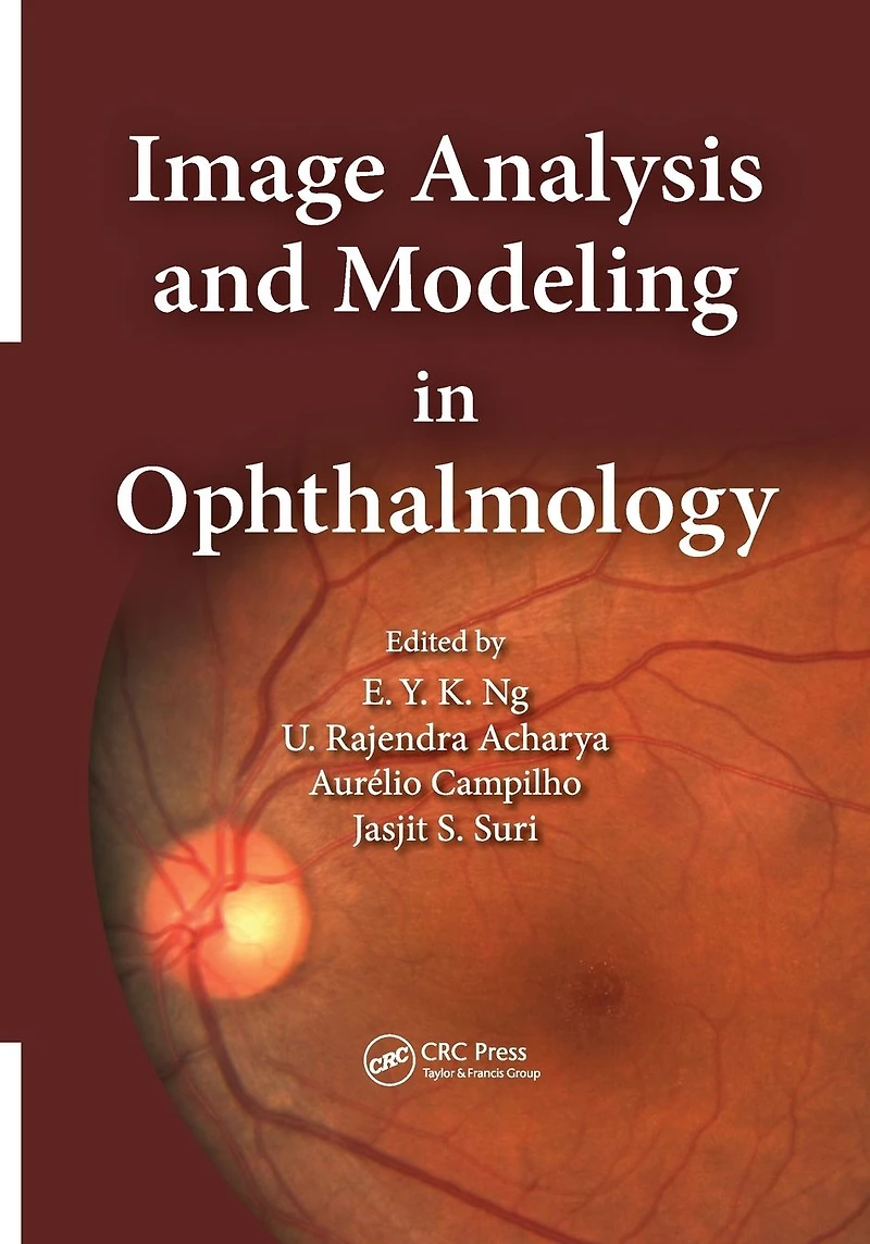 Image Analysis and Modeling Ophthalmology