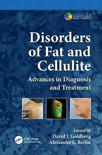 Disorders of Fat and Cellulite: Advances Diagnosis Treatment