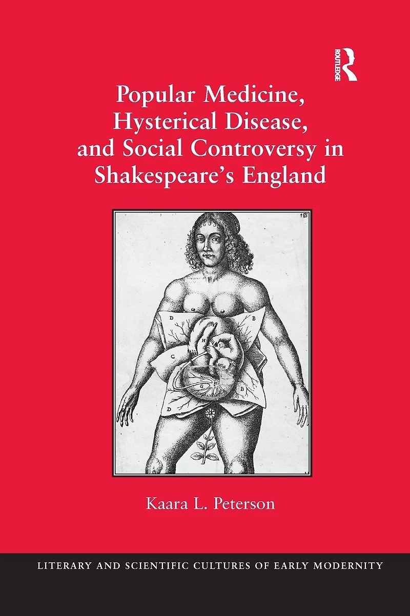 Popular Medicine, Hysterical Disease, and Social Controversy Shakespeare's England