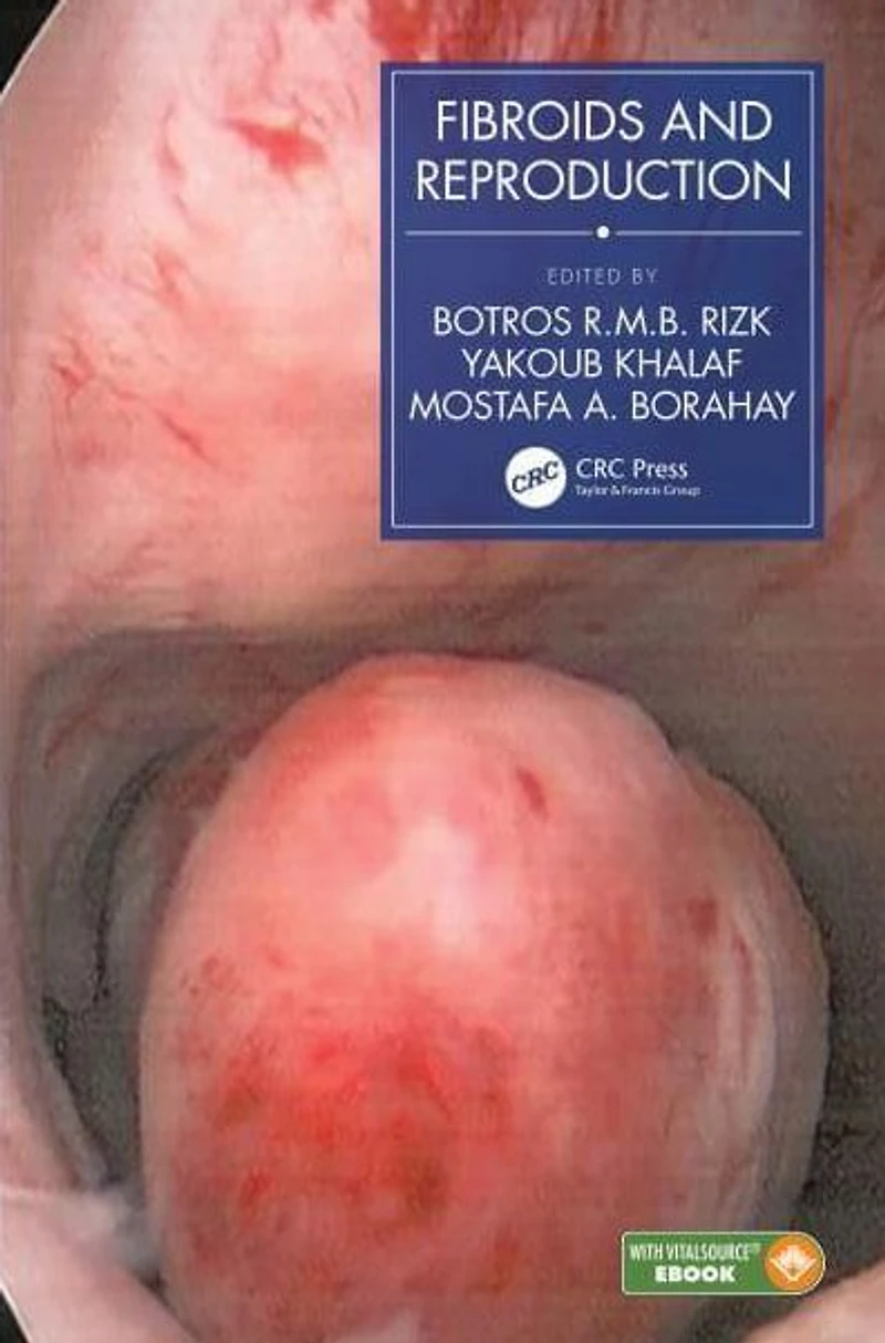 Fibroids and Reproduction