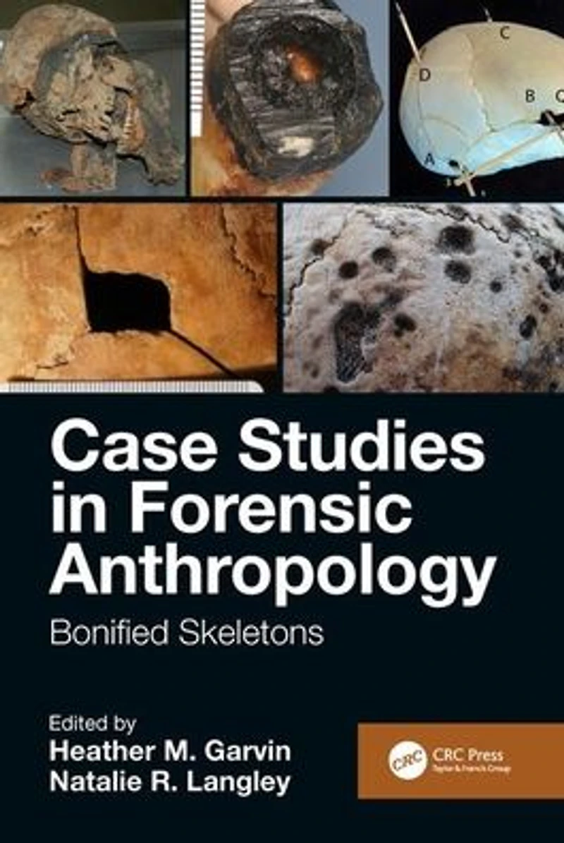 Case Studies Forensic Anthropology: Bonified Skeletons