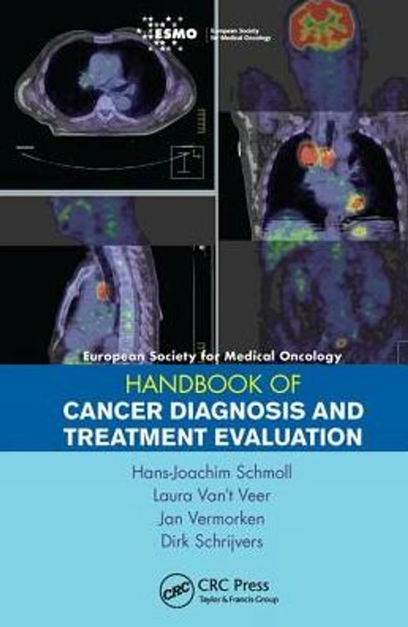 ESMO Handbook of Cancer Diagnosis and Treatment Evaluation