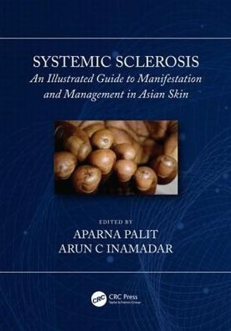 Systemic Sclerosis: An Illustrated Guide to Manifestation and Management Asian Skin